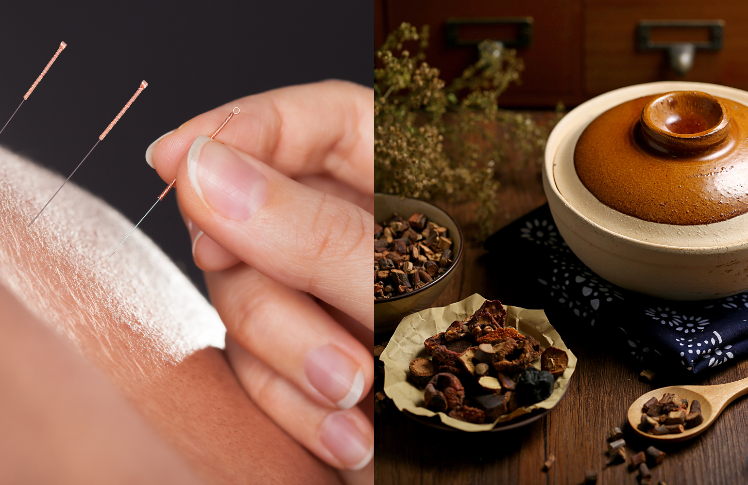 中醫美顏針,針灸原理,臉部針灸效果,中醫美容學